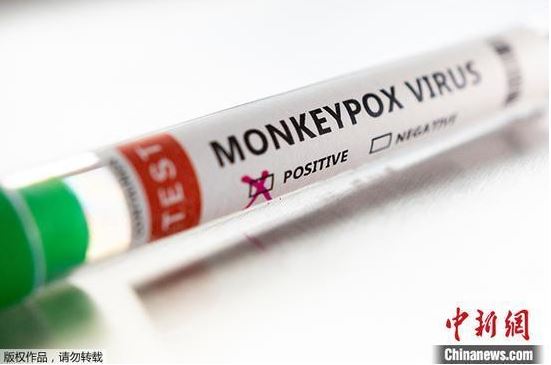 美国洛杉矶县出现首例猴痘死亡病例 系全美已知第2例